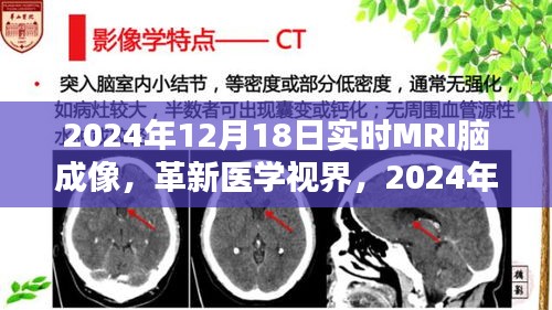 革新医学视界，实时MRI脑成像深度评测与未来展望