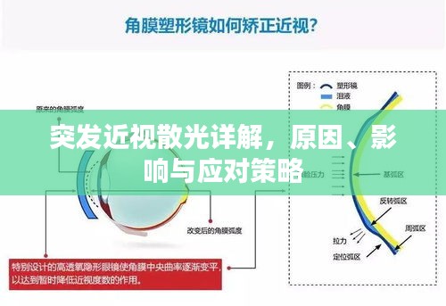 突发近视散光详解，原因、影响与应对策略