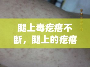 腿上毒疙瘩不断，腿上的疙瘩特别特别多为什么 