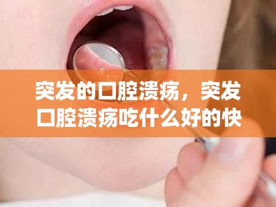 突发的口腔溃疡，突发口腔溃疡吃什么好的快 