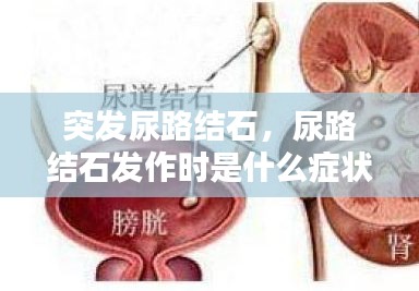 突发尿路结石，尿路结石发作时是什么症状? 