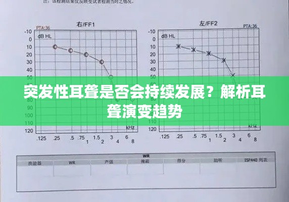 突发性耳聋是否会持续发展？解析耳聋演变趋势