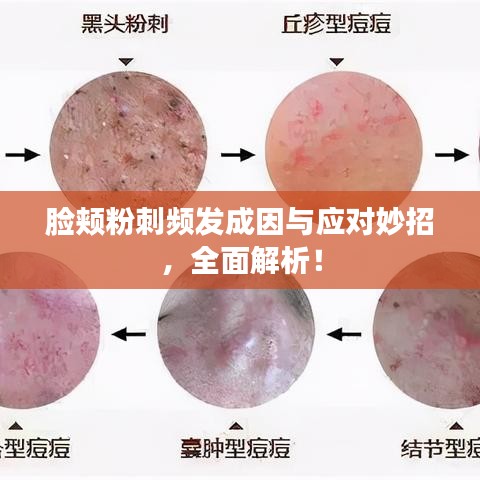 脸颊粉刺频发成因与应对妙招，全面解析！
